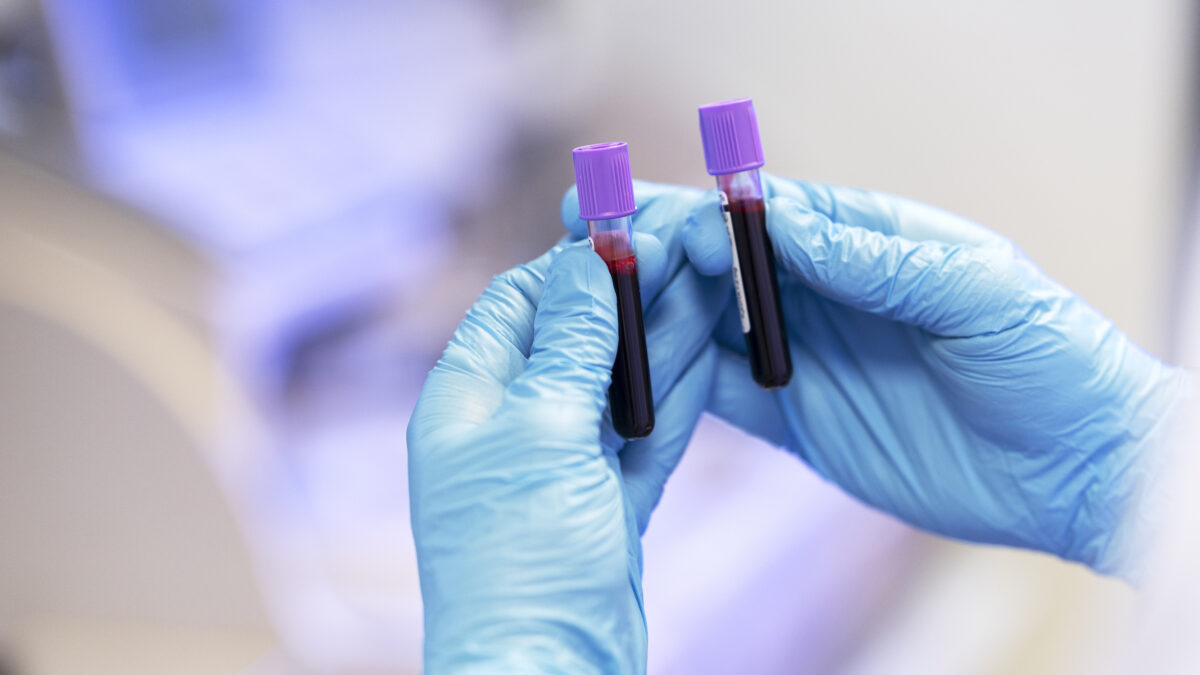 День борьбы со СПИДом: всё о болезни, диагностике, лечении