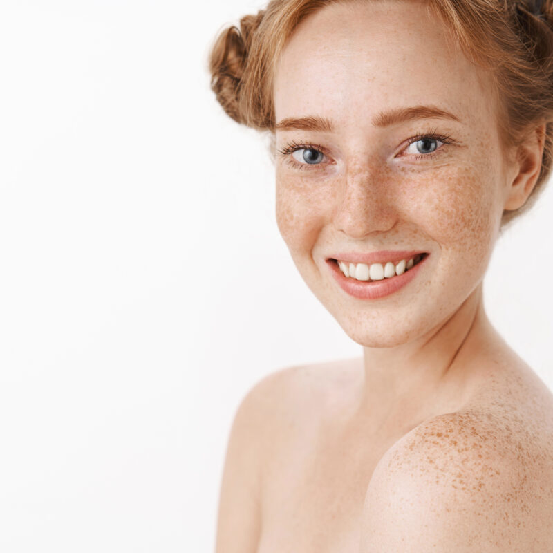 Это опасно? Когда обращаться к врачу? Всё про пигментные пятна: виды, причины и методы борьбы