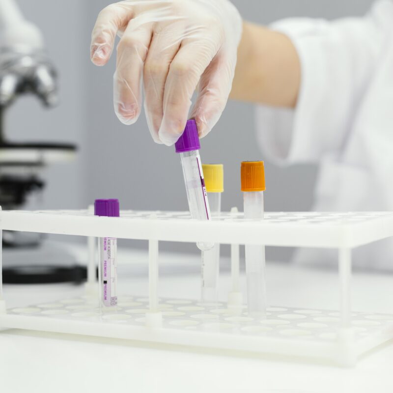 Показатели анализов: что и как часто нужно сдавать, как расшифровать и что делать с результатами