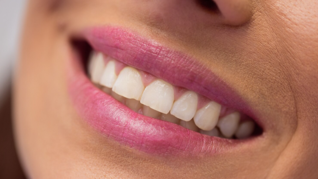 Как отбелить зубы в домашних условиях: советы стоматолога