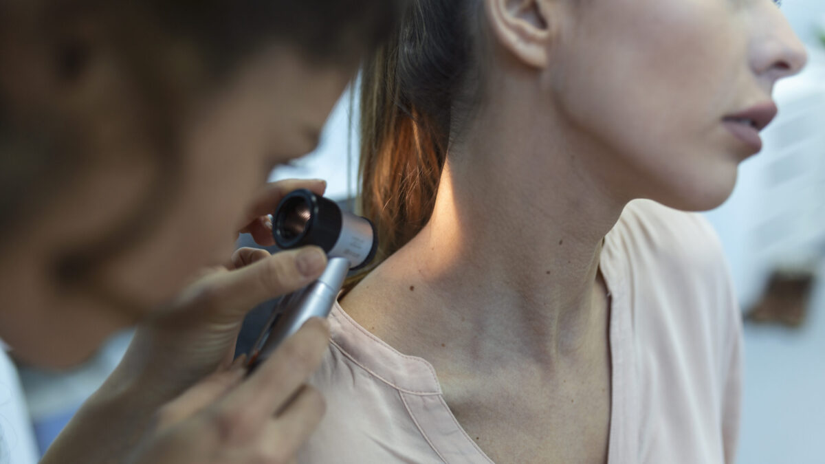 Родинки на теле: почему появляются и чем опасны, если много