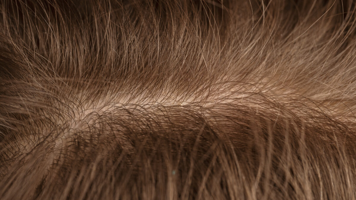 Жирнятся волосы: почему и что делать – пошаговая инструкция