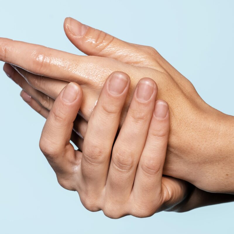 Ни один крем не спасает: что делать с сухостью рук?