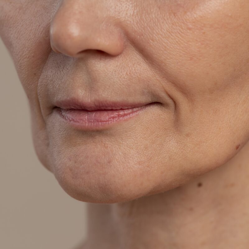 Почему поплыл овал лица и что с этим делать: как подтянуть брыли