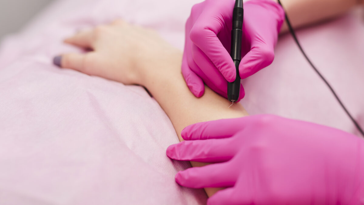 Гладкая кожа на всю жизнь: реально ли это и как на самом деле работает электроэпиляция